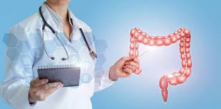 Avvio Screening colon retto popolazione Distretto Sanitario Ariano Irpino Avvio Screening colon retto popolazione Distretto Sanitario Ariano Irpino