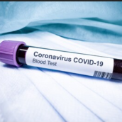 Coronavirus, tampone negativo per la figlia del ginecologo di Ariano Irpino Coronavirus, tampone negativo per la figlia del ginecologo di Ariano Irpino