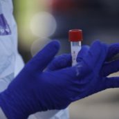 Test rapidi, dall’Asl di Avellino più trasparenza su tutte le procedure Test rapidi, dall’Asl di Avellino più trasparenza su tutte le procedure