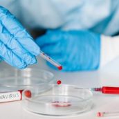 Coronavirus, Mercogliano: la positiva è una 55enne Coronavirus, Mercogliano: la positiva è una 55enne