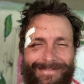 Jovanotti finisce fuori strada a Castel Rigone: “Nulla di grave, solo graffi e costole incrinate” Jovanotti finisce fuori strada a Castel Rigone: “Nulla di grave, solo graffi e costole incrinate”