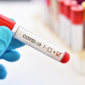 Covid, 12 positivi al virus in Irpinia