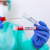 Covid, il bollettino di oggi: 854 persone positive al virus in Irpinia