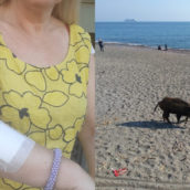 Donna viene morsa da un cinghiale in spiaggia Donna viene morsa da un cinghiale in spiaggia