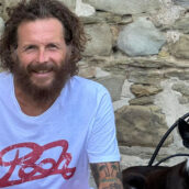 Jovanotti: “Dopo l’incidente in bicicletta ho una gamba più corta, come Pantani” Jovanotti: “Dopo l’incidente in bicicletta ho una gamba più corta, come Pantani”