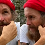 Jovanotti: “Non riesco ancora a camminare senza stampelle. Ho combinato un gran casino” Jovanotti: “Non riesco ancora a camminare senza stampelle. Ho combinato un gran casino”